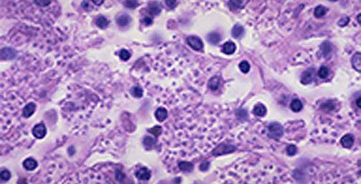 Histoplasmosis Disinfection